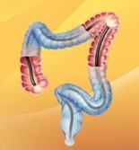 Endoscopie Constanta