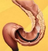 Endoscopie Constanta