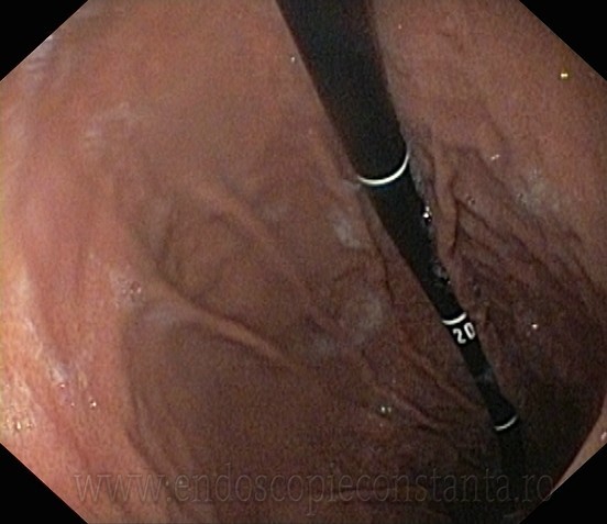 Endoscopie Constanta