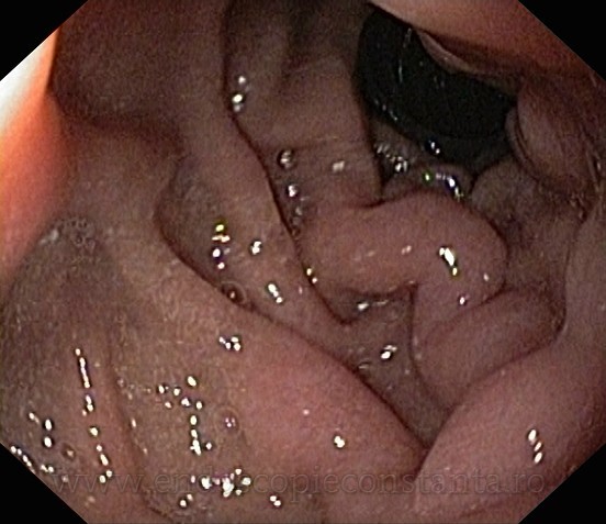 Endoscopie Constanta