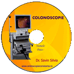 Colonoscopie Constanta